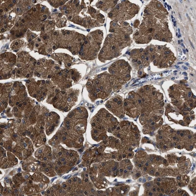 PPM1K Antibody in Immunohistochemistry (IHC)