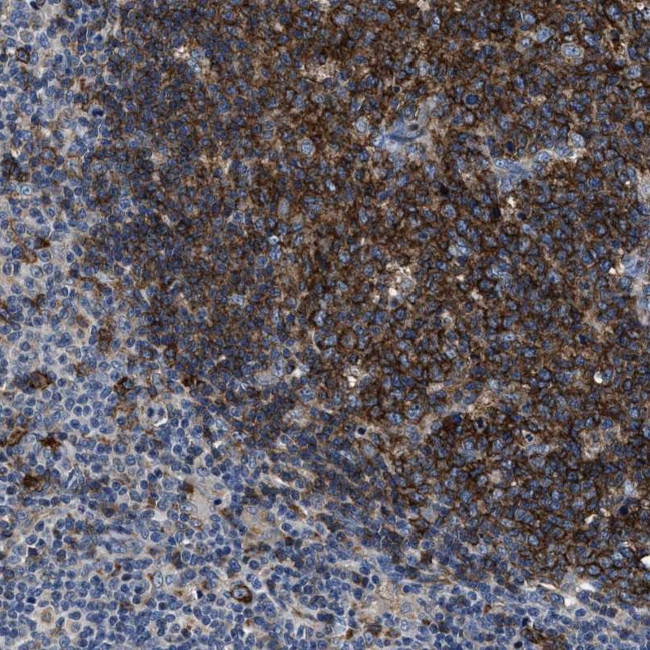 C2orf66 Antibody in Immunohistochemistry (Paraffin) (IHC (P))