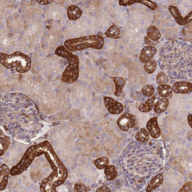 ZNF237 Antibody in Immunohistochemistry (Paraffin) (IHC (P))