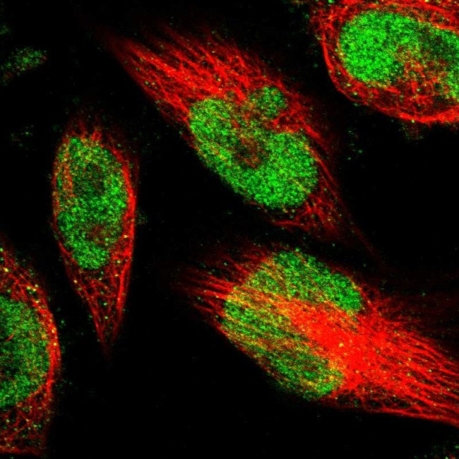 METTL1 Antibody in Immunocytochemistry (ICC/IF)