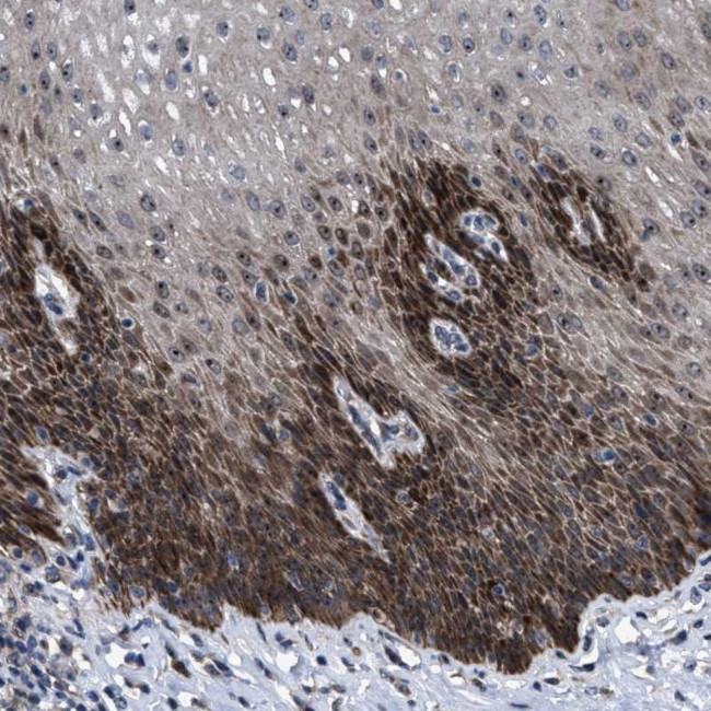 HAUS6 Antibody in Immunohistochemistry (Paraffin) (IHC (P))