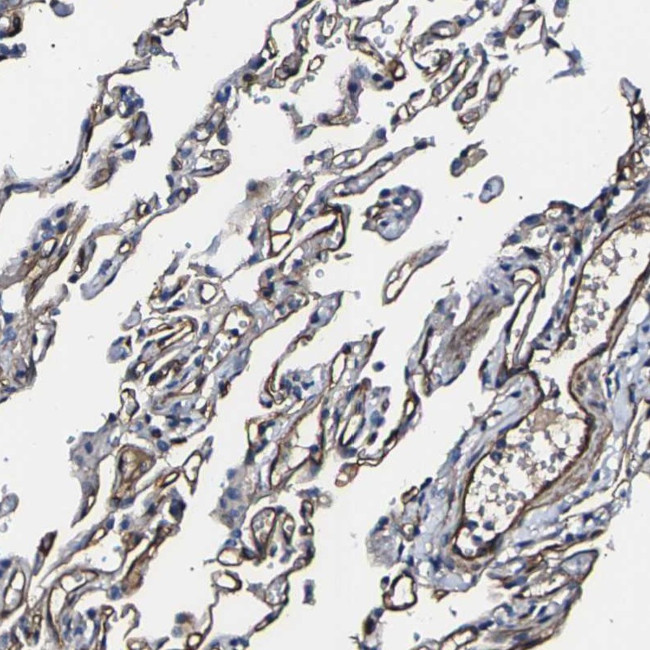 KLHDC5 Antibody in Immunohistochemistry (Paraffin) (IHC (P))