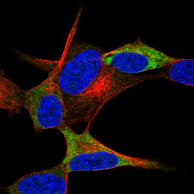 NACAD Antibody in Immunocytochemistry (ICC/IF)