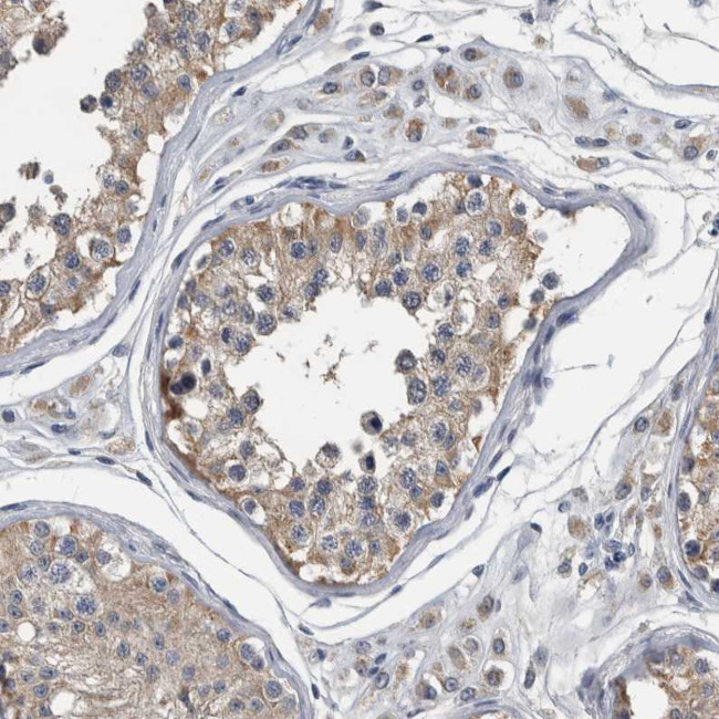 MURC Antibody in Immunohistochemistry (Paraffin) (IHC (P))