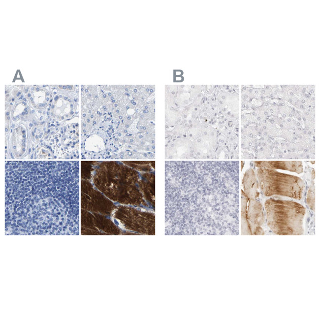 MYBPC1 Antibody in Immunohistochemistry (IHC)
