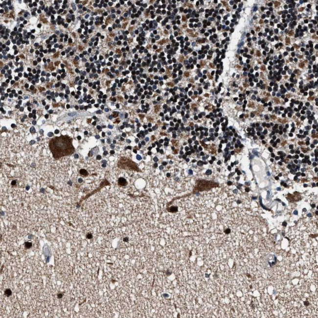 PRRC2B Antibody in Immunohistochemistry (Paraffin) (IHC (P))