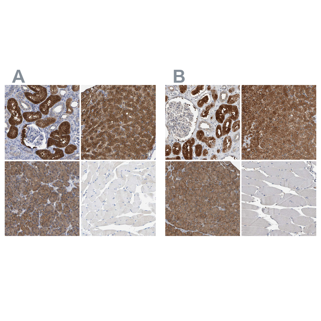ALAD Antibody in Immunohistochemistry (Paraffin) (IHC (P))