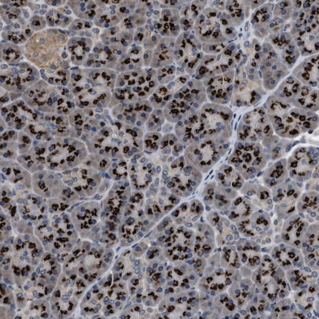 TPST2 Antibody in Immunohistochemistry (Paraffin) (IHC (P))