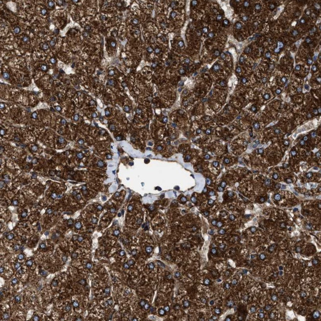 TPP2 Antibody in Immunohistochemistry (Paraffin) (IHC (P))