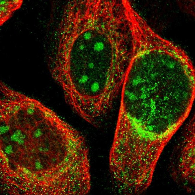 ZCCHC7 Antibody in Immunocytochemistry (ICC/IF)