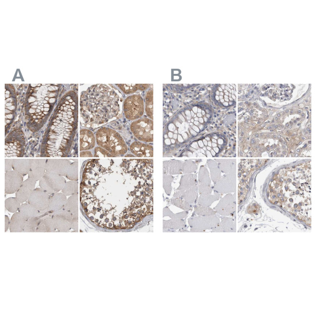 Ataxin 2 Antibody in Immunohistochemistry (IHC)