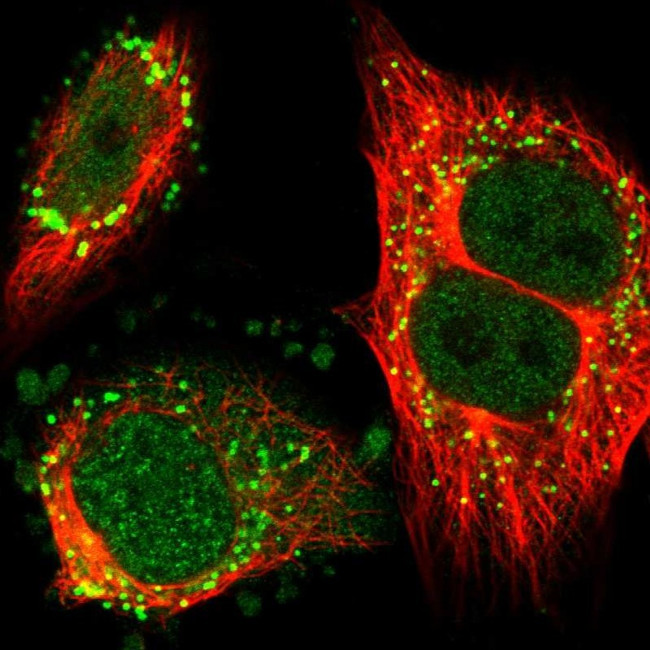 ZNF614 Antibody in Immunocytochemistry (ICC/IF)