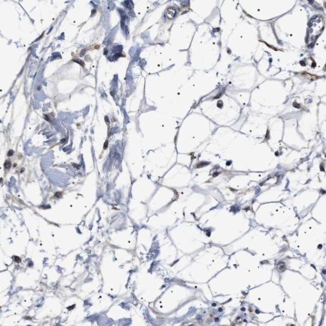 PTRH1 Antibody in Immunohistochemistry (Paraffin) (IHC (P))