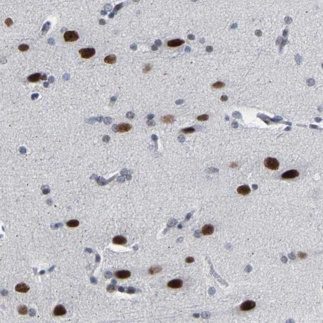 FAM180A Antibody in Immunohistochemistry (Paraffin) (IHC (P))