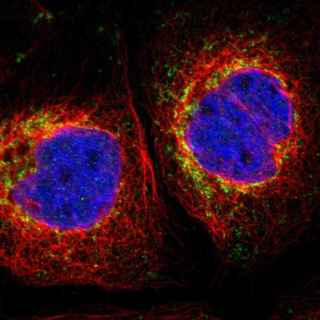 MRPL10 Antibody in Immunocytochemistry (ICC/IF)