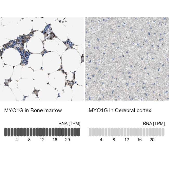 MYO1G Antibody in Immunohistochemistry (IHC)
