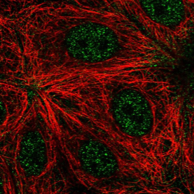RNF208 Antibody in Immunocytochemistry (ICC/IF)