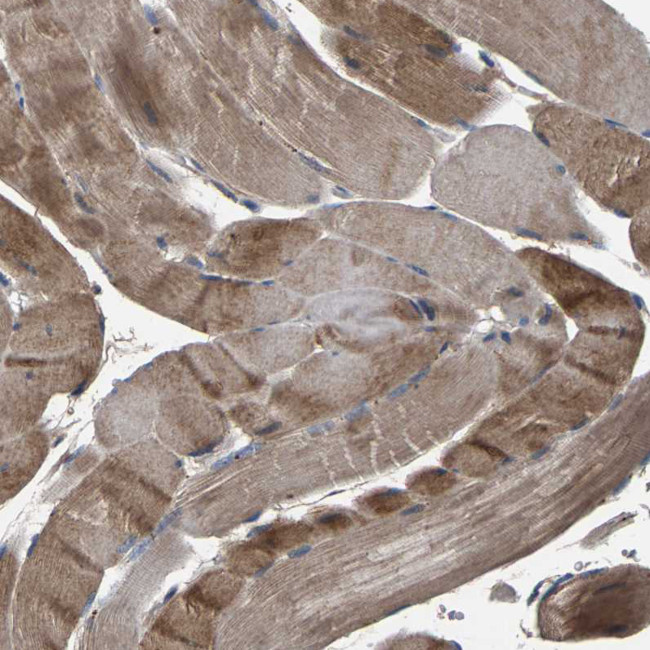 AAED1 Antibody in Immunohistochemistry (Paraffin) (IHC (P))