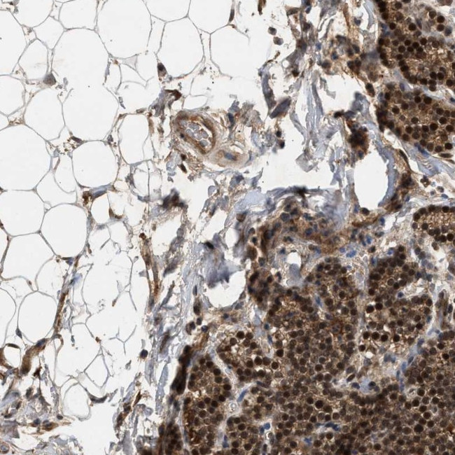 RUSC2 Antibody in Immunohistochemistry (Paraffin) (IHC (P))