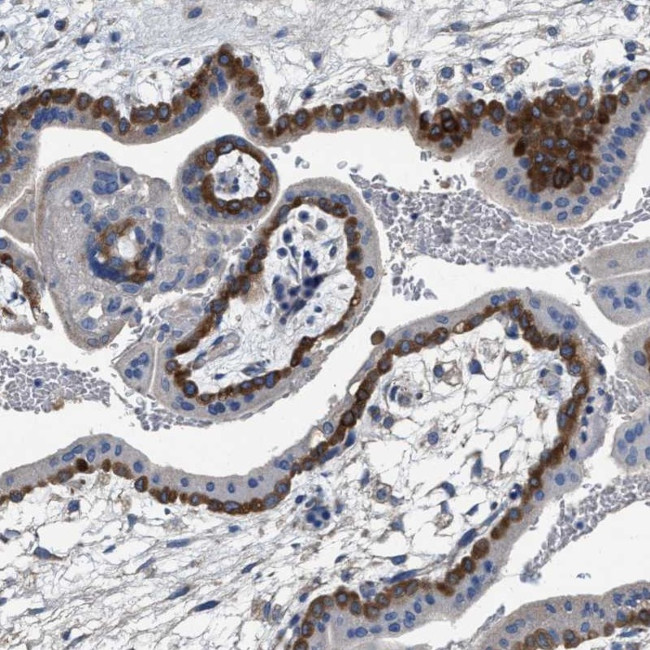 PEG10 Antibody in Immunohistochemistry (Paraffin) (IHC (P))