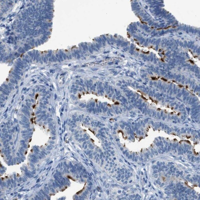 C9orf171 Antibody in Immunohistochemistry (IHC)