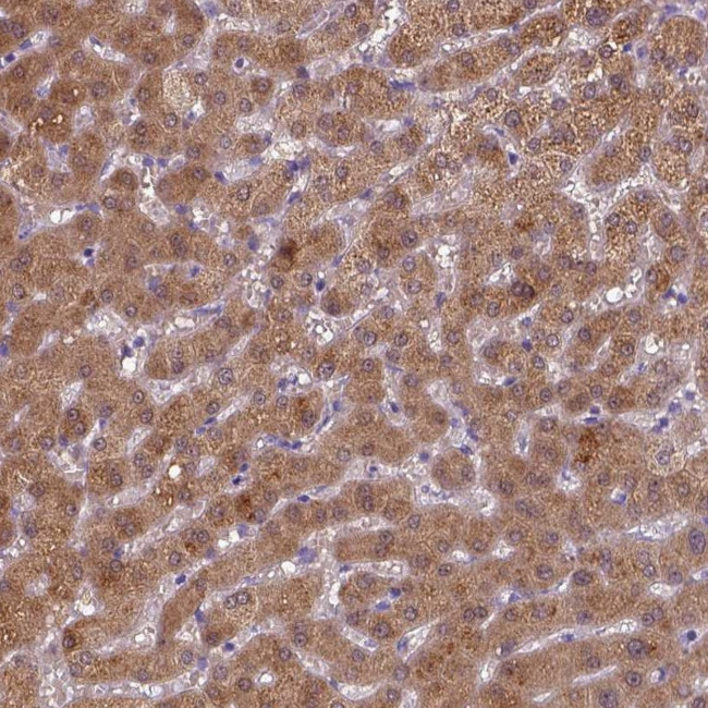 BAAT Antibody in Immunohistochemistry (Paraffin) (IHC (P))