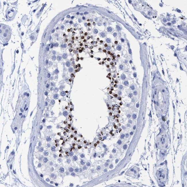 INSL6 Antibody in Immunohistochemistry (Paraffin) (IHC (P))