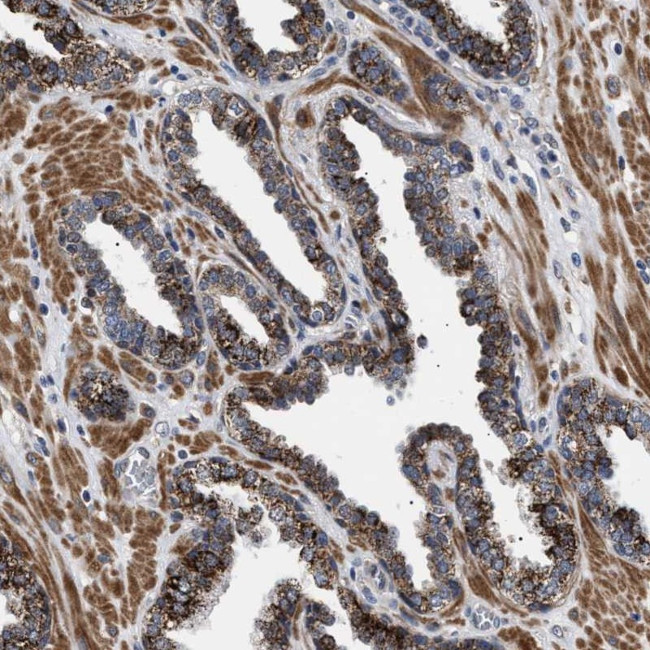 RAB34 Antibody in Immunohistochemistry (Paraffin) (IHC (P))