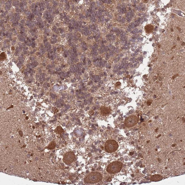 ADAMTS3 Antibody in Immunohistochemistry (Paraffin) (IHC (P))