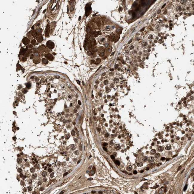 FICD Antibody in Immunohistochemistry (Paraffin) (IHC (P))