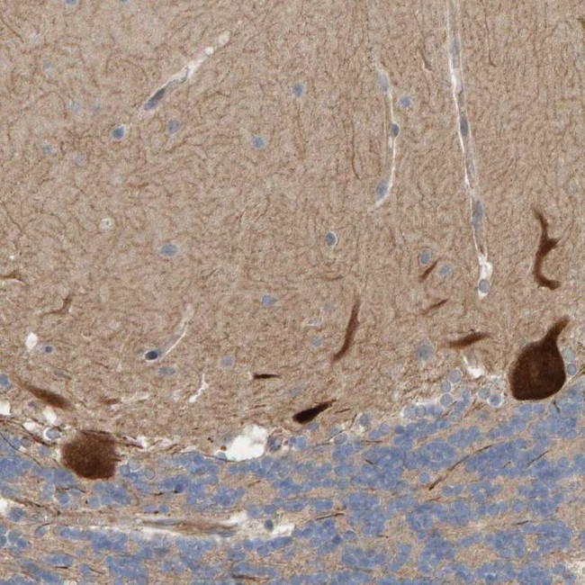 LRSAM1 Antibody in Immunohistochemistry (IHC)
