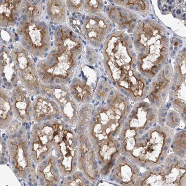 VSTM2A Antibody in Immunohistochemistry (Paraffin) (IHC (P))