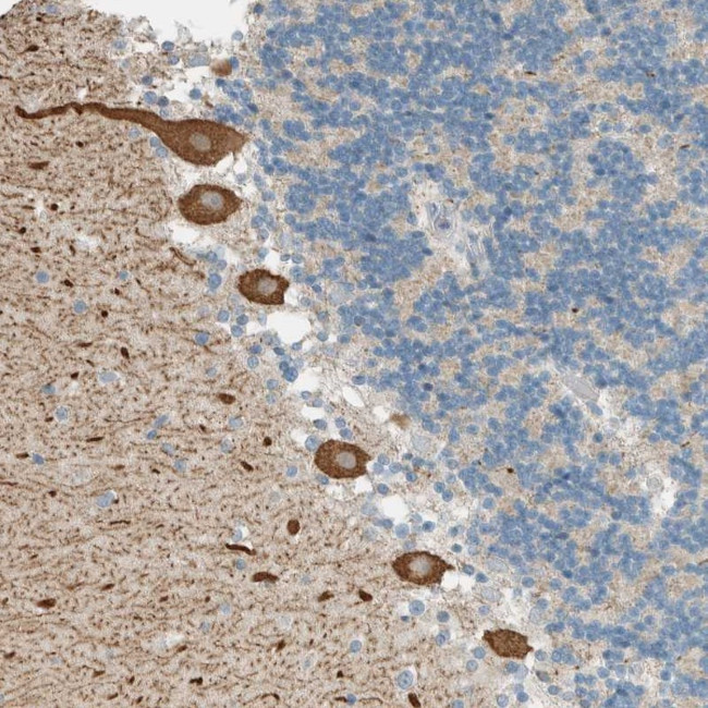 PTGES3L-AARSD1 Antibody in Immunohistochemistry (Paraffin) (IHC (P))