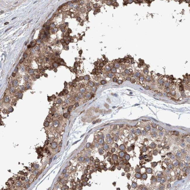 NSP5 Antibody in Immunohistochemistry (IHC)