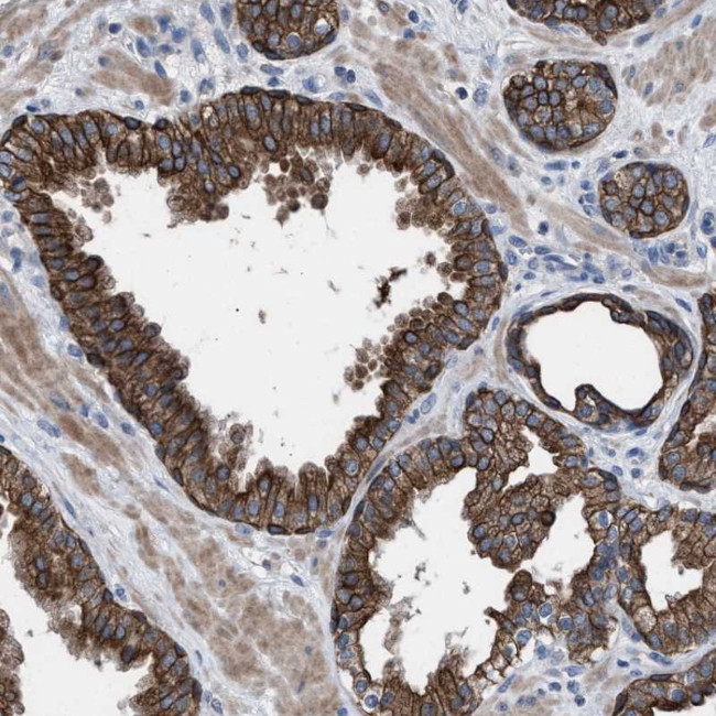 Adenylate Kinase 8 Antibody in Immunohistochemistry (Paraffin) (IHC (P))