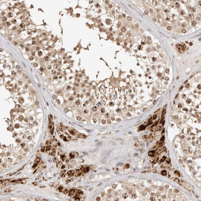 SEC14L1 Antibody in Immunohistochemistry (Paraffin) (IHC (P))