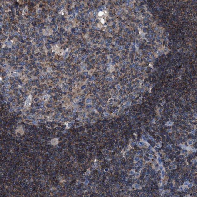SMAP2 Antibody in Immunohistochemistry (Paraffin) (IHC (P))