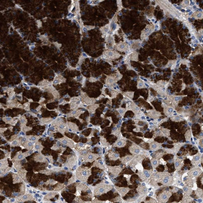 HSD17B14 Antibody in Immunohistochemistry (Paraffin) (IHC (P))