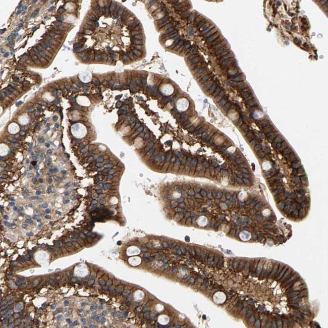 FAM78A Antibody in Immunohistochemistry (Paraffin) (IHC (P))