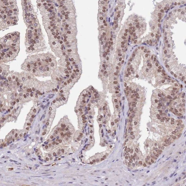 FAM120AOS Antibody in Immunohistochemistry (IHC)