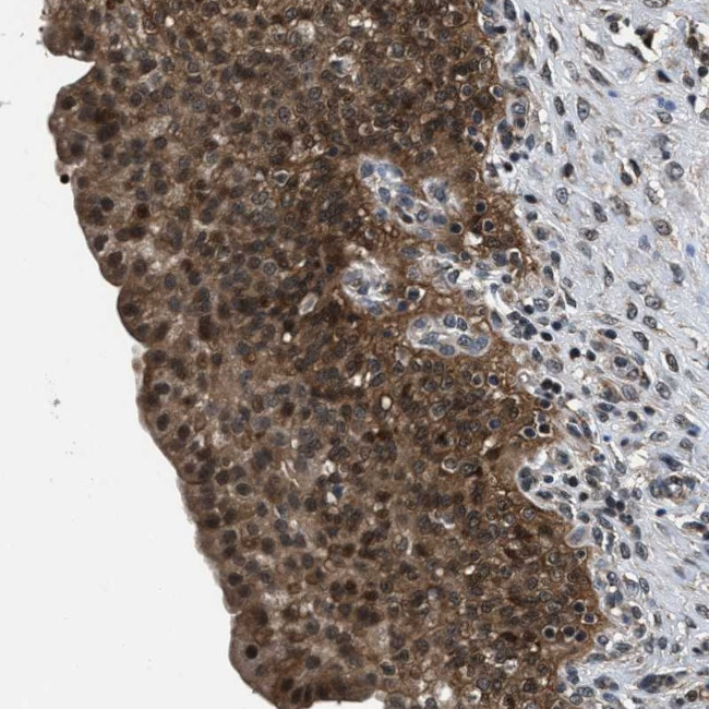 RBM33 Antibody in Immunohistochemistry (Paraffin) (IHC (P))