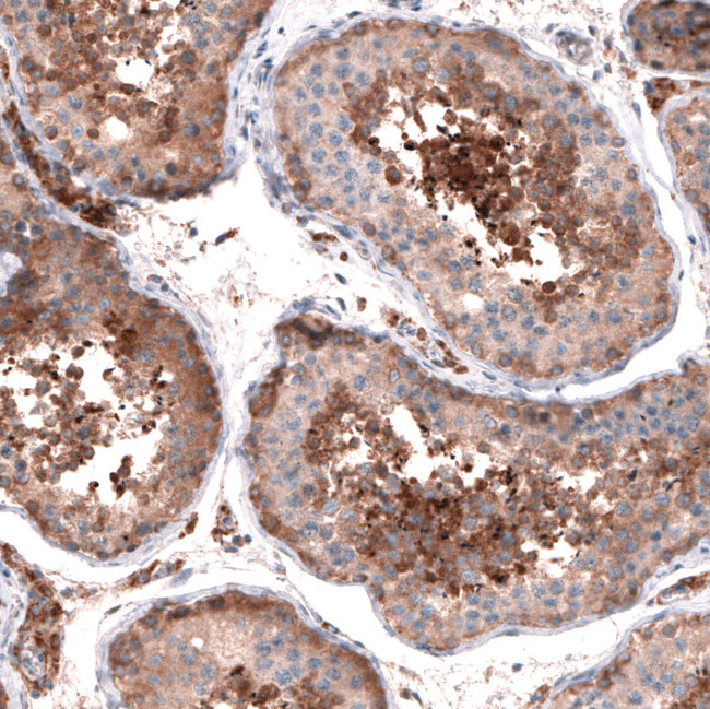OSBP2 Antibody in Immunohistochemistry (IHC)