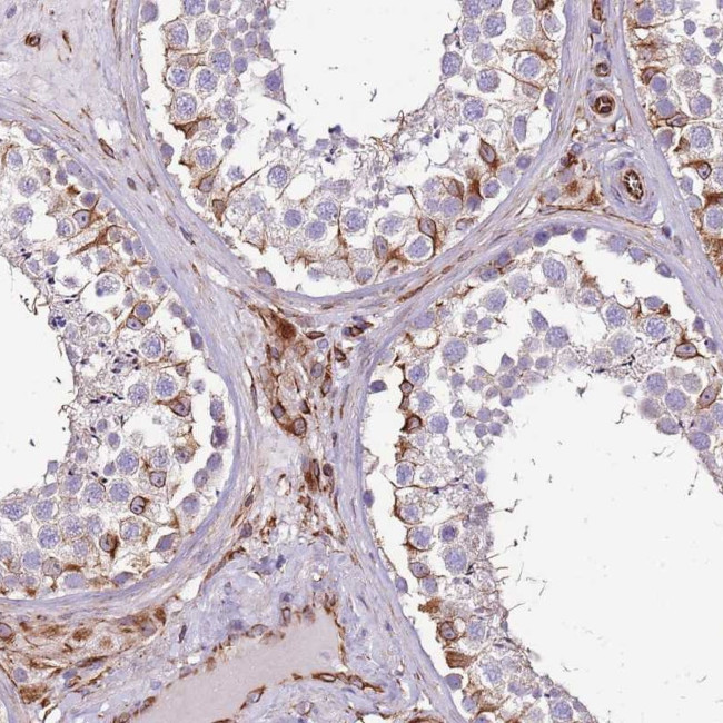 ZNF786 Antibody in Immunohistochemistry (Paraffin) (IHC (P))