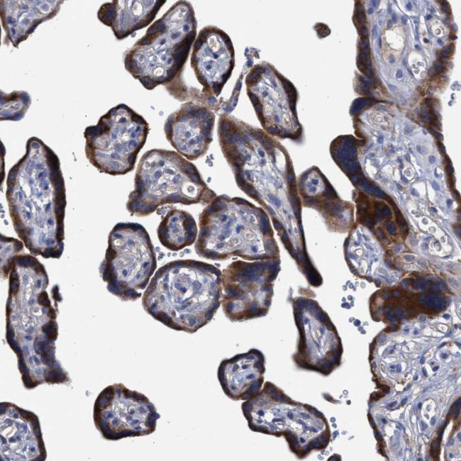 SVEP1 Antibody in Immunohistochemistry (IHC)