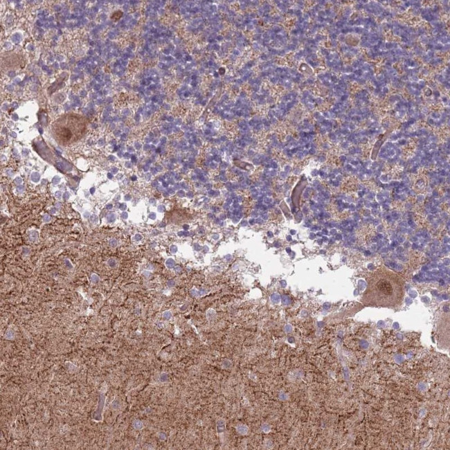 CREBZF Antibody in Immunohistochemistry (Paraffin) (IHC (P))