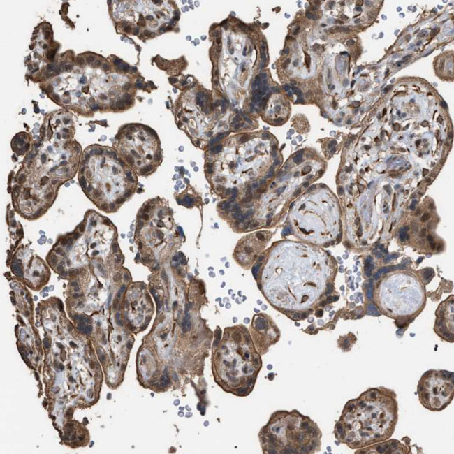 MAK10 Antibody in Immunohistochemistry (Paraffin) (IHC (P))