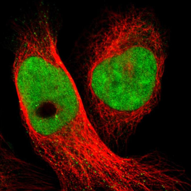 SMCR8 Antibody in Immunocytochemistry (ICC/IF)
