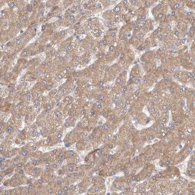 SCO1 Antibody in Immunohistochemistry (IHC)