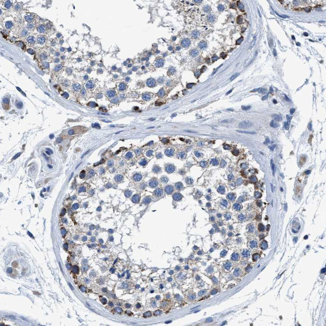 ANKFN1 Antibody in Immunohistochemistry (Paraffin) (IHC (P))