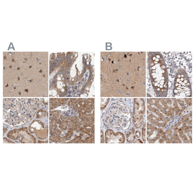 SCO1 Antibody in Immunohistochemistry (IHC)